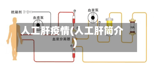 人工肝疫情(人工肝简介)