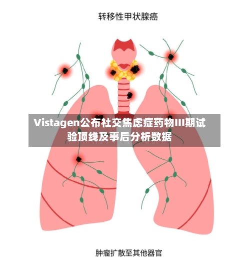 Vistagen公布社交焦虑症药物III期试验顶线及事后分析数据