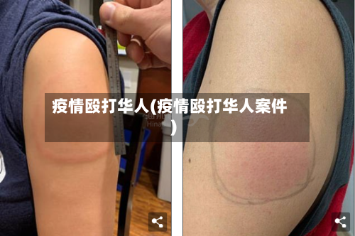 疫情殴打华人(疫情殴打华人案件)