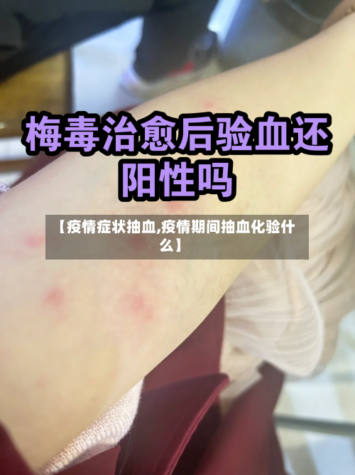 【疫情症状抽血,疫情期间抽血化验什么】