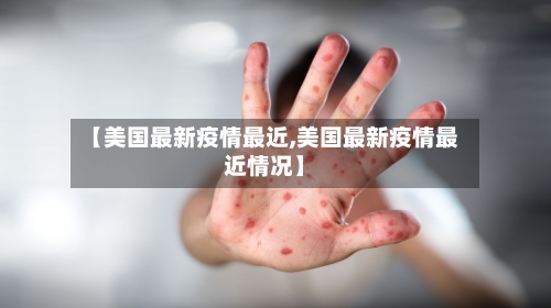 【美国最新疫情最近,美国最新疫情最近情况】