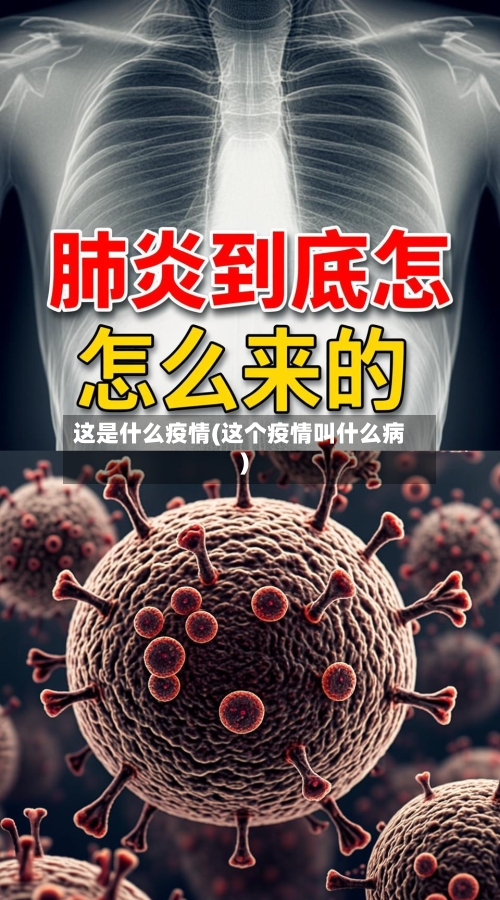 这是什么疫情(这个疫情叫什么病)-第3张图片