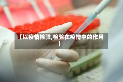 【以疫情检验,检验在疫情中的作用】