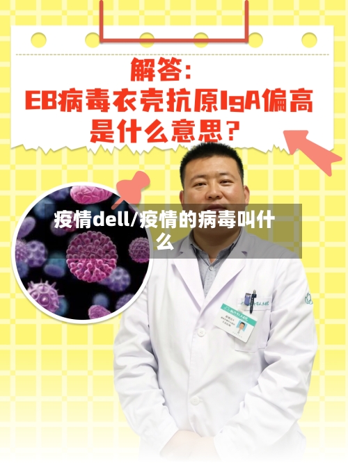 疫情dell/疫情的病毒叫什么-第2张图片