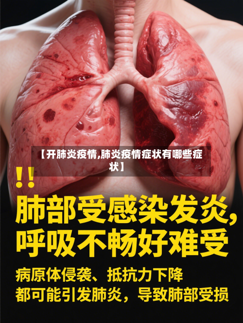 【开肺炎疫情,肺炎疫情症状有哪些症状】-第3张图片