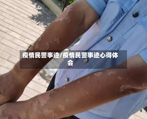 疫情民警事迹/疫情民警事迹心得体会-第3张图片