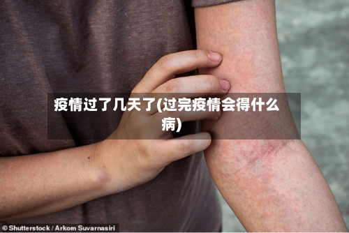 疫情过了几天了(过完疫情会得什么病)