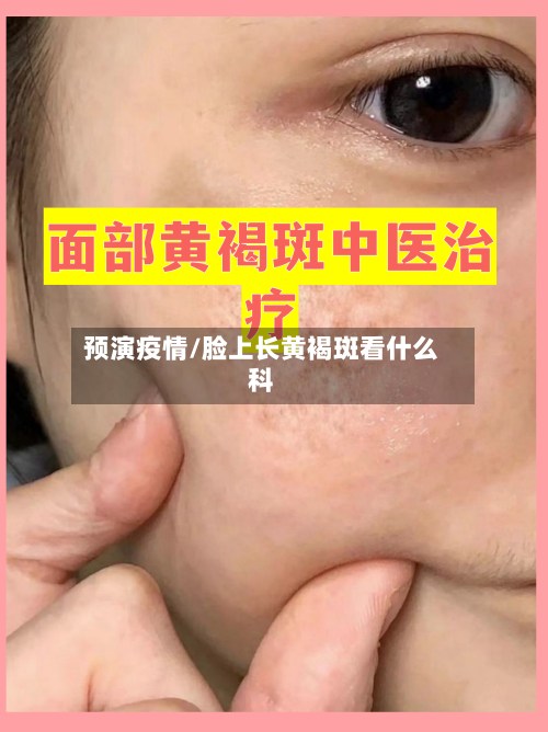 预演疫情/脸上长黄褐斑看什么科