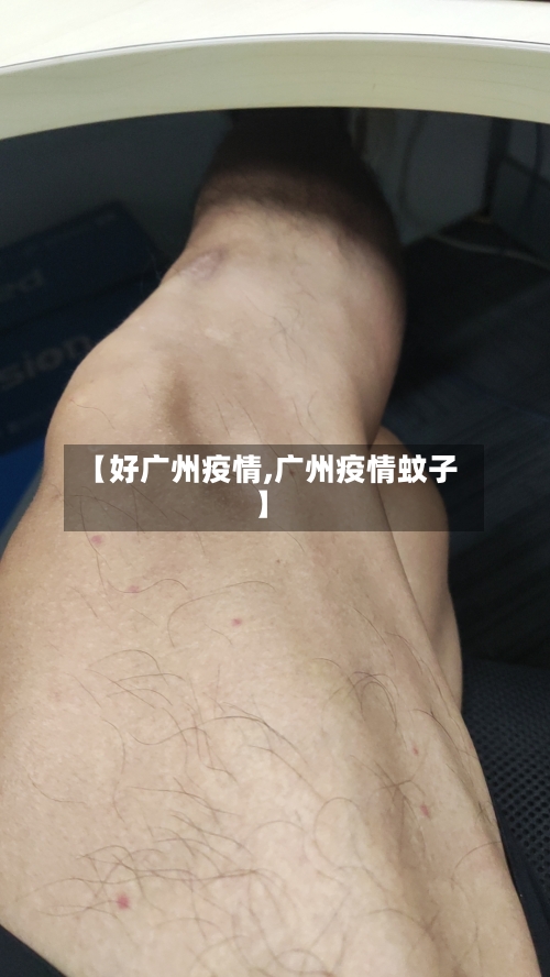 【好广州疫情,广州疫情蚊子】